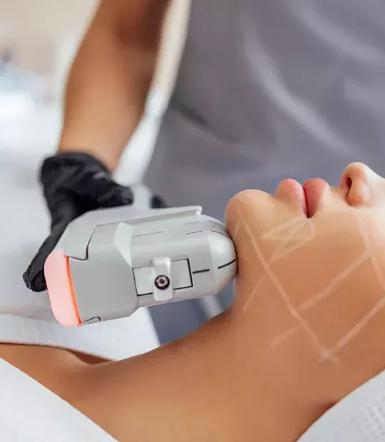 HIFU 7D en Tijuana, Resultados Naturales